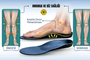 Ortopedik tabanlık çeşitleri ve ayak destek ürünleri