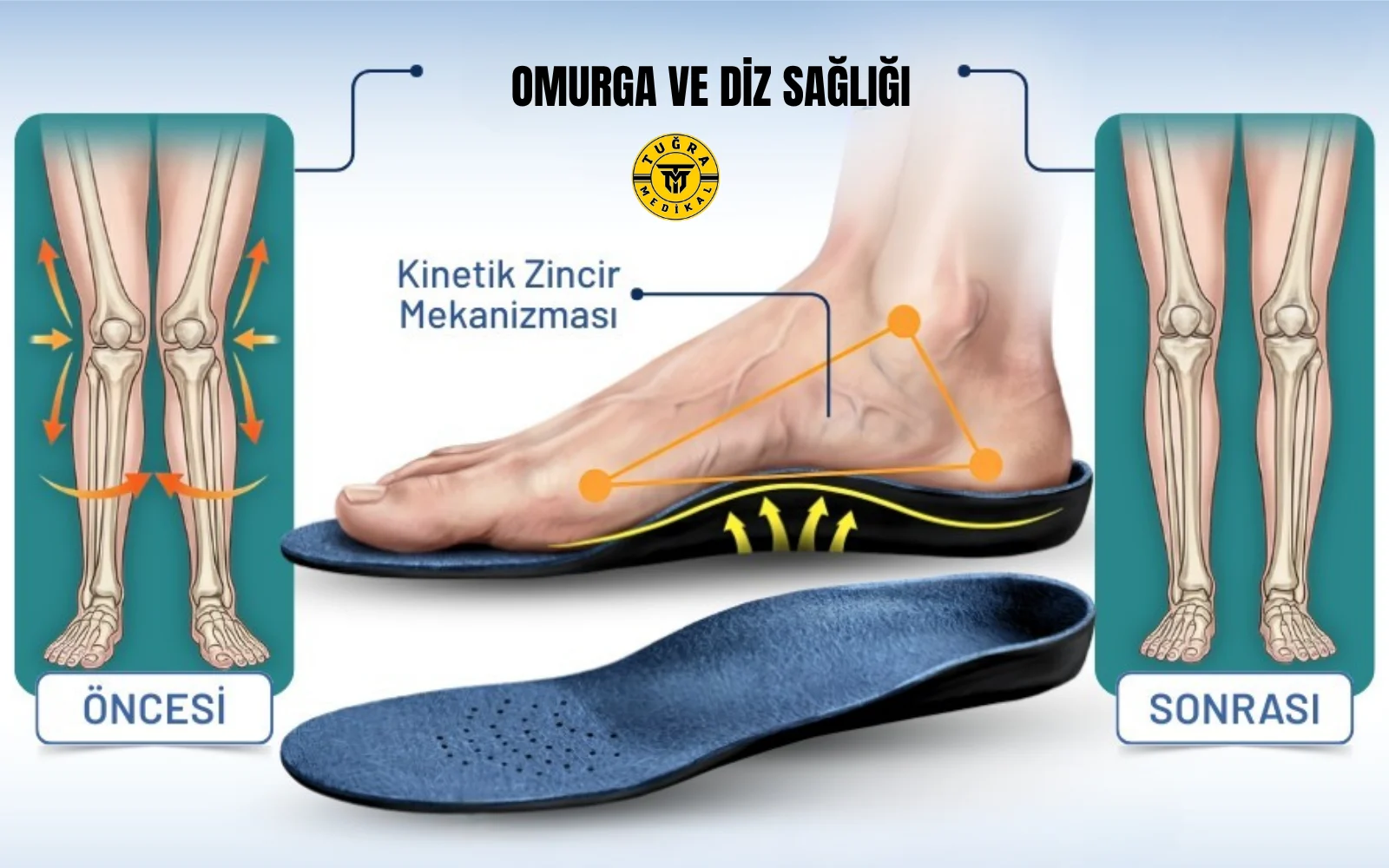 Ortopedik tabanlık çeşitleri ve ayak destek ürünleri